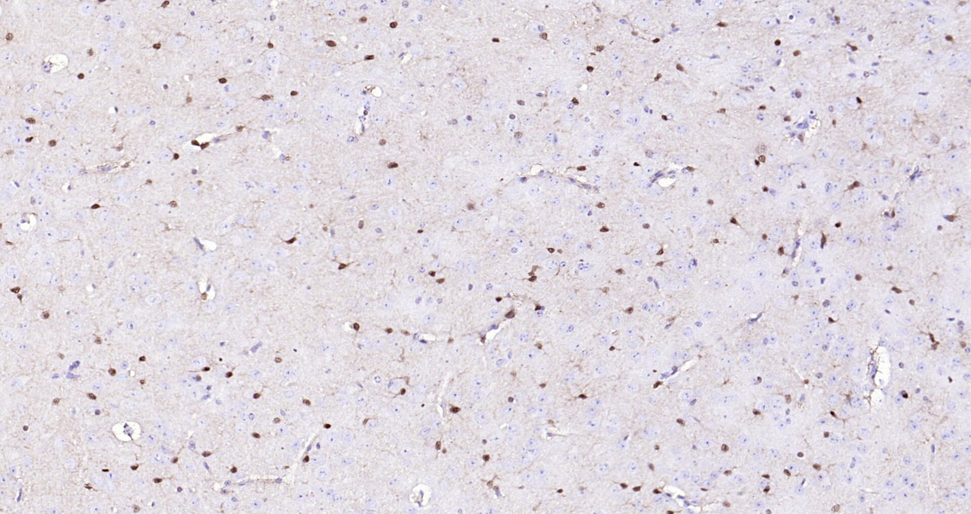 蛋白单克隆即用型免疫组化试剂盒-IHC0110